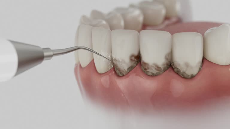 Reliable Dental contractor in Lancaster, WI by Smile Center Dentistry
